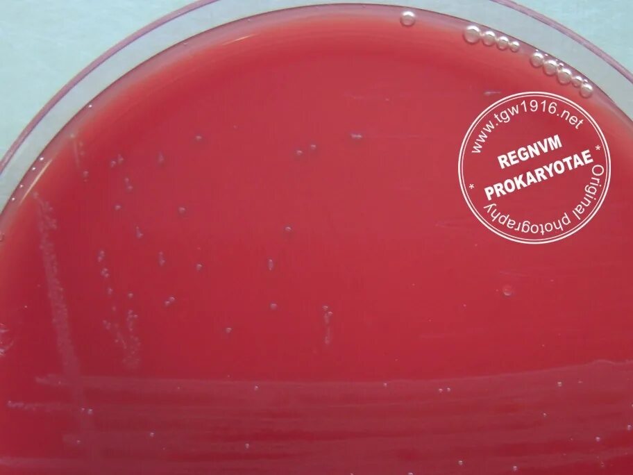 Тест на стрептококки в аптеке. Streptococcus agalactiae на кровяном агаре. Стрептококк агалактия на кровяном агаре. S. agalactiae в питательная среда. S аgalacticae стрептококк.