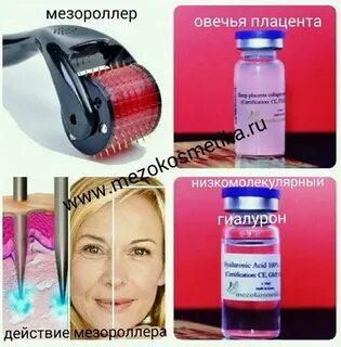 Сколько раз использовать мезороллер
