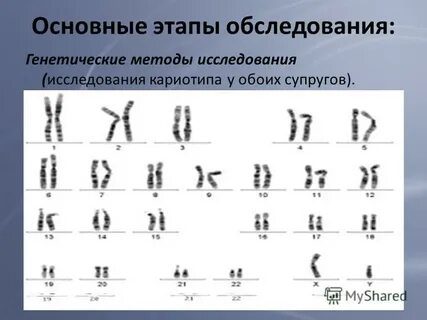 Кдл кариотип