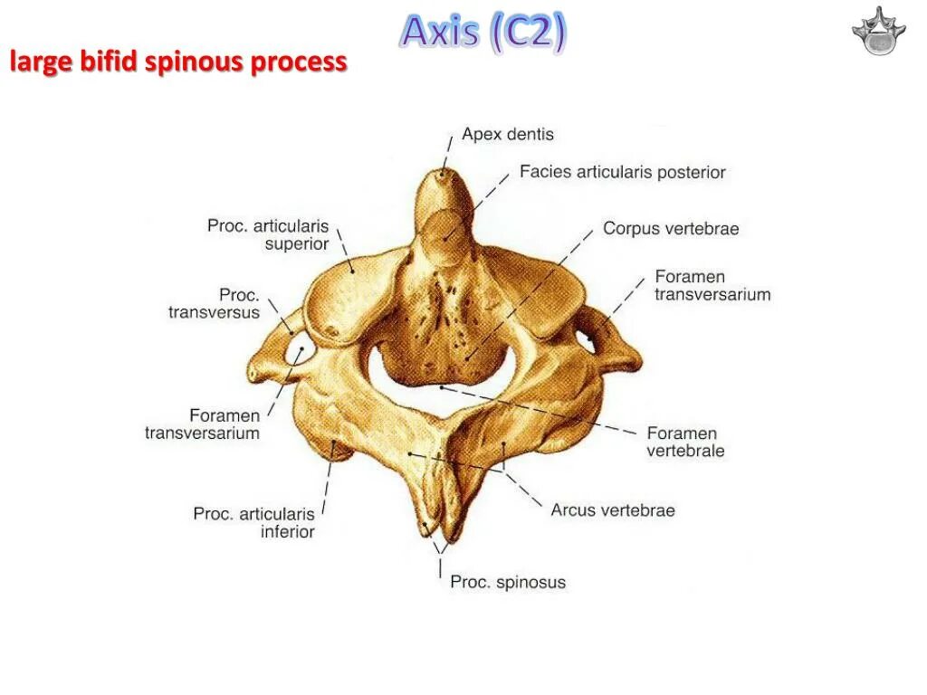 Dens axis. Аксис анатомия. axis axis — аксис. анатомия аксис латынь. facies articularis superior аксис.