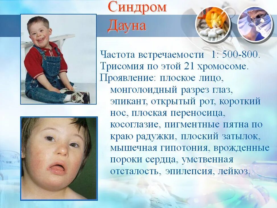 Синдром дауна встречается. Синдром дауна. синдром дауна презентация. болезнь дауна презентация. дети с болезнью дауна.