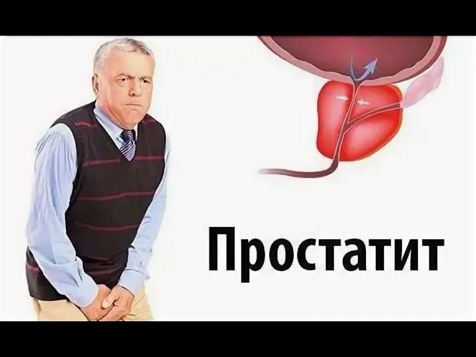 Простатит что можно и нельзя. Простатит реклама. простатит рисунок.