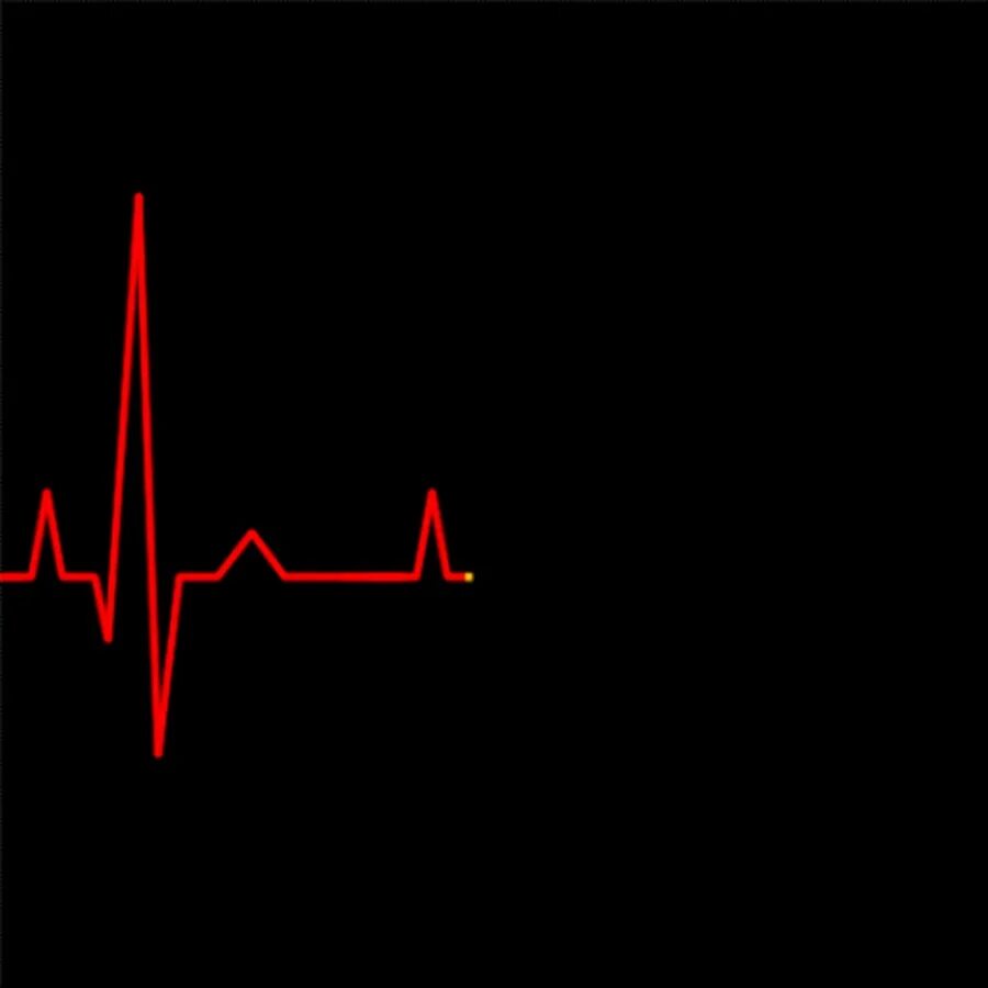 Эффект сердцебиения. Кардиограмма. Кардиограмма сердца. Кардиограмма gif. Кардиограмма серлце.