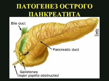 Можно ли бананы при панкреатите