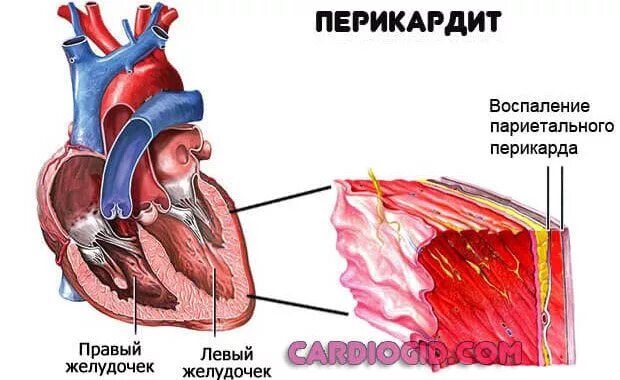 Сердце окружено околосердечной сумкой. Сердце краткое описание. Слепой мешок перикарда saccus caecus pericardii. Сердце окружено околосердечной сумкой. Сердце окружено околосердечной сумкой.