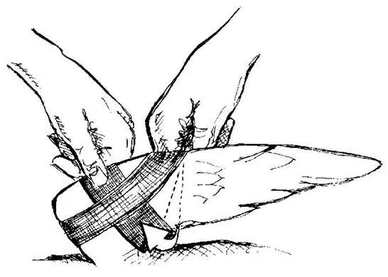 Сломано крыло что делать. Фиксация крыла у птицы при переломе. Как зафиксировать сломанное крыло у птицы.