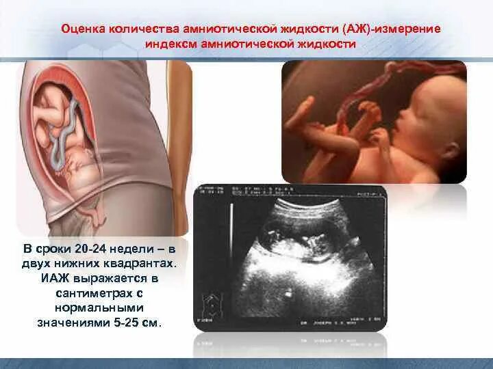 Количество вод ИАЖ. Измерение амниотической жидкости. Измерение околоплодных вод на УЗИ. ИАЖ УЗИ. Околоплодные воды 20 недель