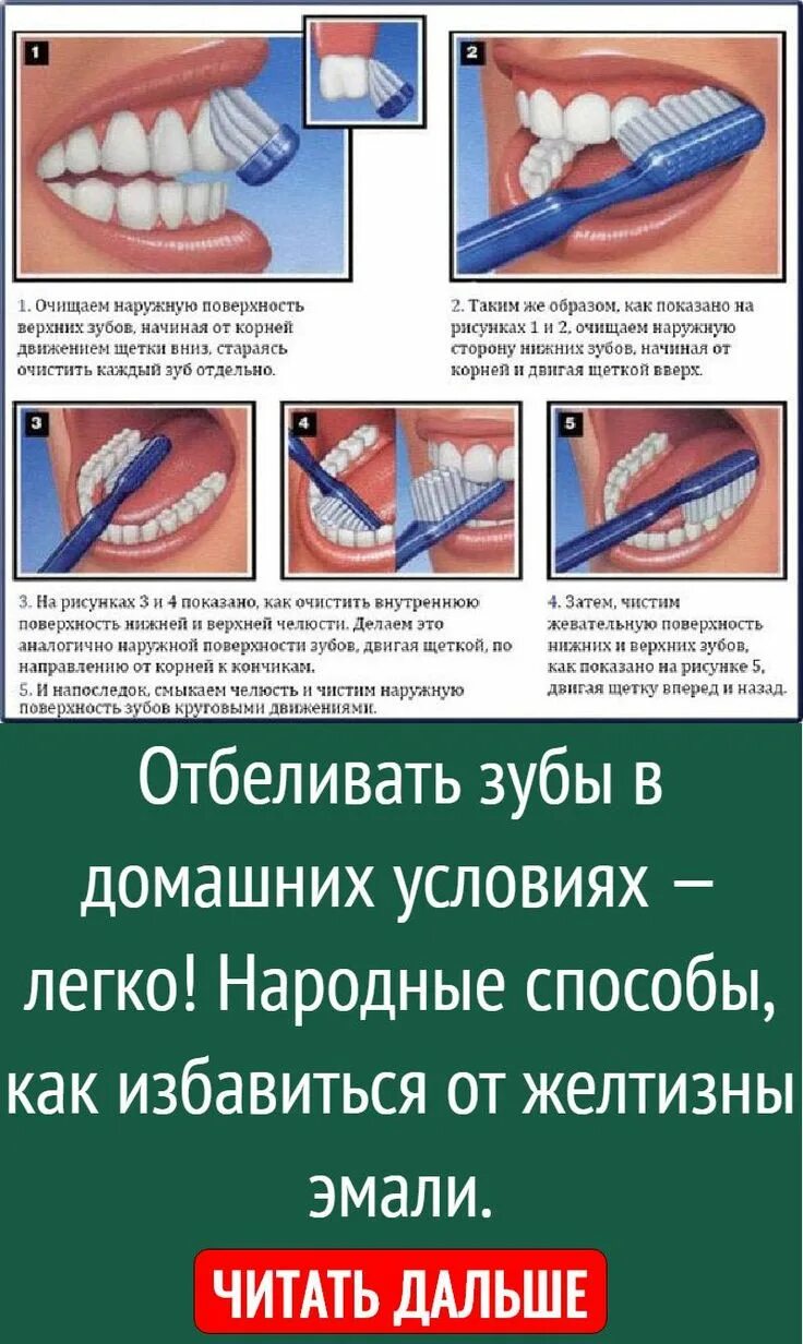 Как правильно отбеливать зубы. Как отбелить зубы в домашнем условии.