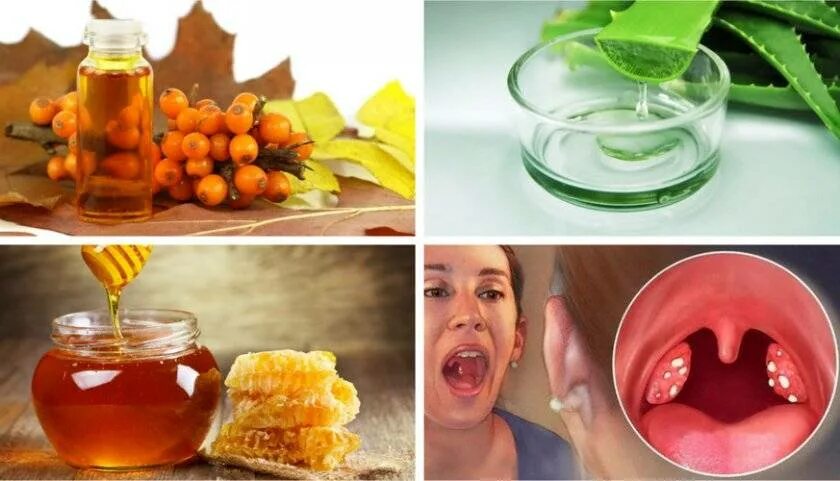 Лечить горло народными. Настой для полоскания горла. Лечить горло народными. Бронхит народные средства. Человек с больным горлом.