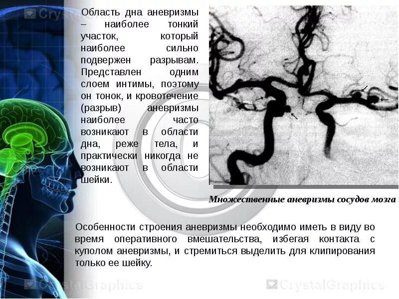Аневризма головного мозга симптомы последствия лечение. Аневризма головного мозга симптомы. аневризм головного мозга что это такое симптомы. аневризма сосудов головы. симптомы аневризма головного мозга симптомы.