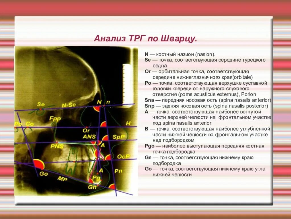 Новости и 1 точка. Анализ ТРГ. ТРГ В боковой проекции по Шварцу. Анализ ТРГ по Шварцу. Анализ телерентгенограмма.