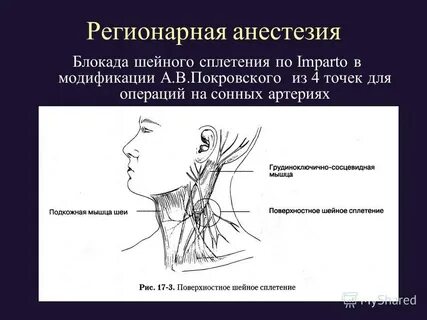 Шейная блокада отзывы