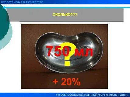 20 08 это