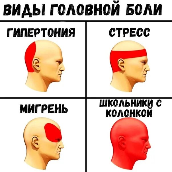 Типы головной боли. Типы головной боли Мем. Мемы про мигрень. Голова болит Мем