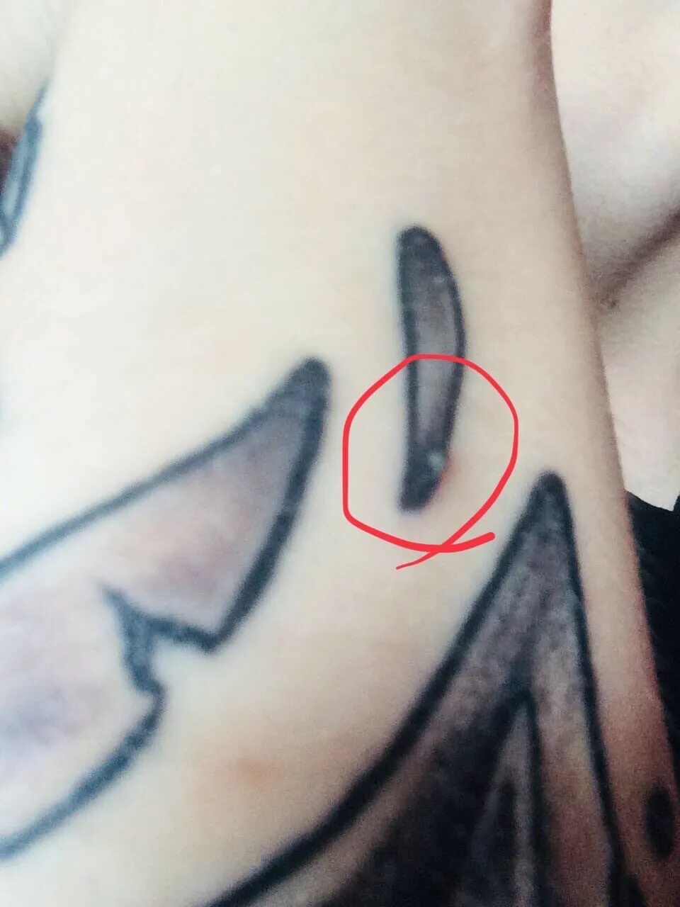 Прыщи на татуировке. Маленькие прыщи на тату. Прыщи на татуировке. Прыщи на татуировке. Маленькие прыщики на татуировке.