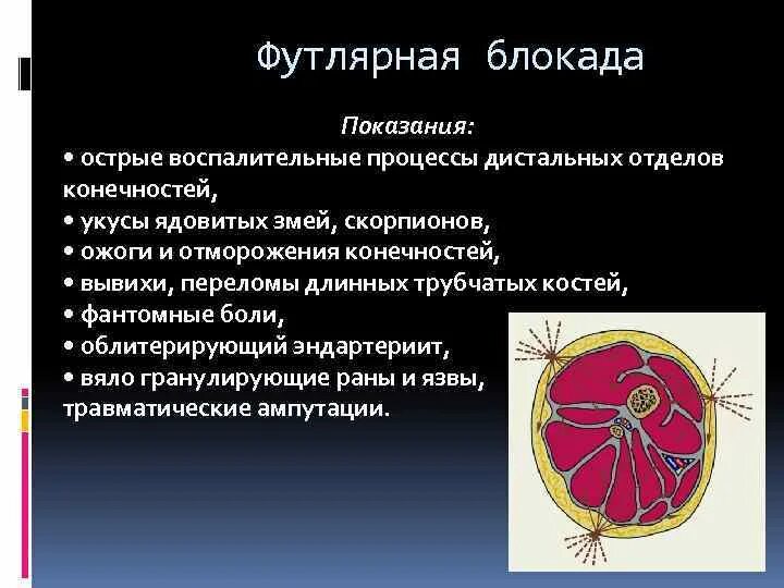 Блокада показания. Футлярная новокаиновая блокада по Вишневскому. Футлярная блокада показания. Футлярная новокаиновая блокада показания. Футлярная блокада плеча показания.