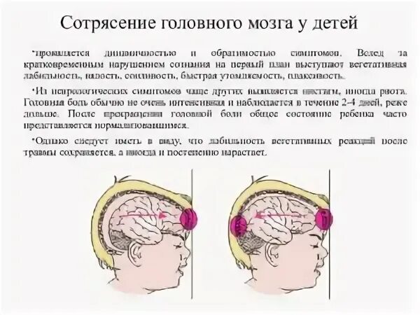 Как проверить сотрясение головы