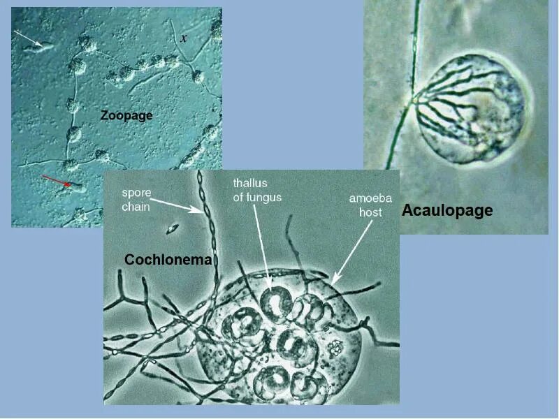 Споры низших грибов. ZOOPAGE. Низшие грибы в протерозое. В клетках низших грибов(Муфав).
