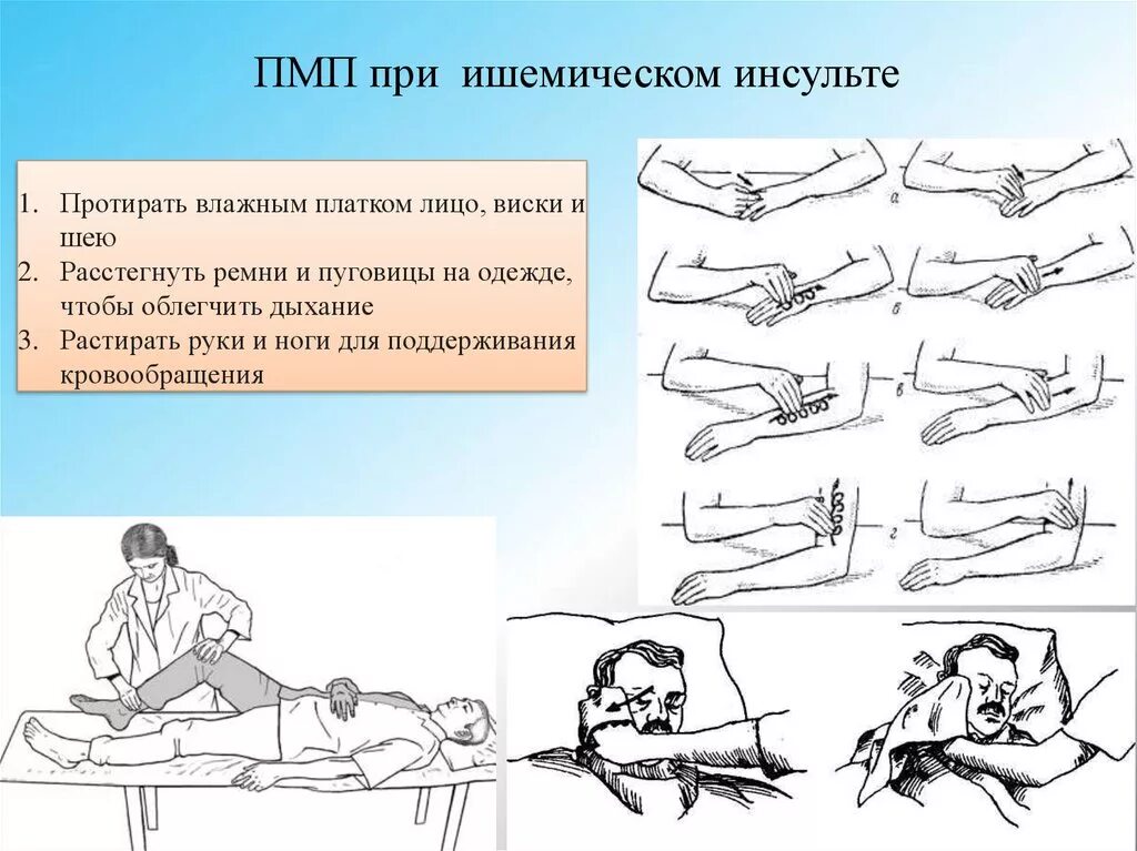 Что нужно при инсульте. ПМП при ишемическом инсульте. Первая мед помощь при ишемическом инсульте. Первая помощь при инсульте алгоритм. Алгоритм оказания первой помощи при инсульте.