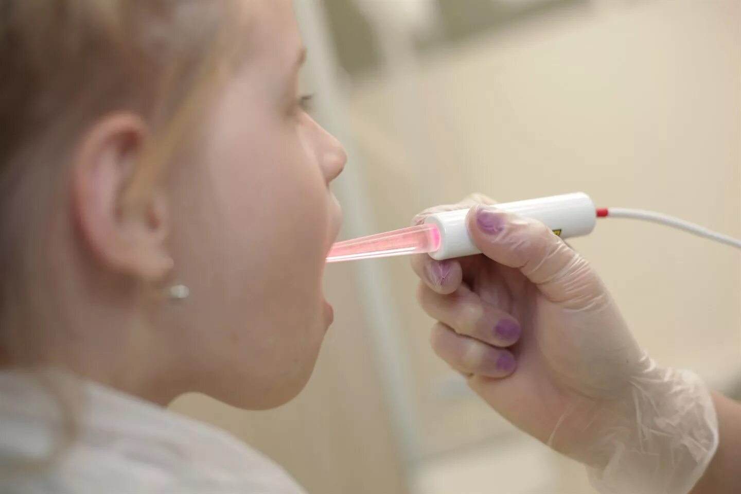 Лазеротерапия носа детям. Лазер физиотерапия при аденоидах. Аденоиды лазером физиолечение. Аденоиды лазеротерапия. Лазеротерапия носа детям.