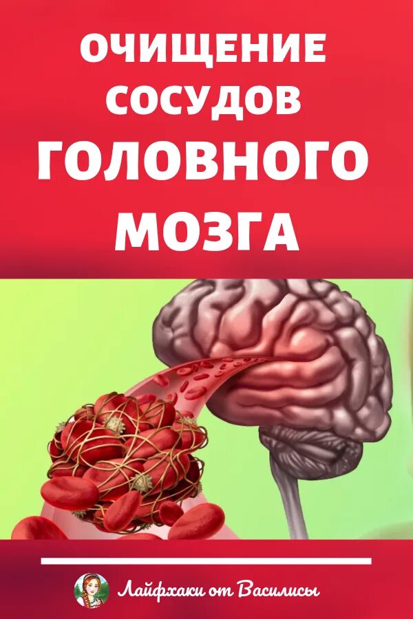 Очистка сосудов головы. Очищение сосудов головного. Таблетки для сосудов головного мозга. Чистка сосудов головного мозга. Продукты для очищения сосудов головного мозга.