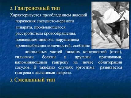 Эрготизм симптомы