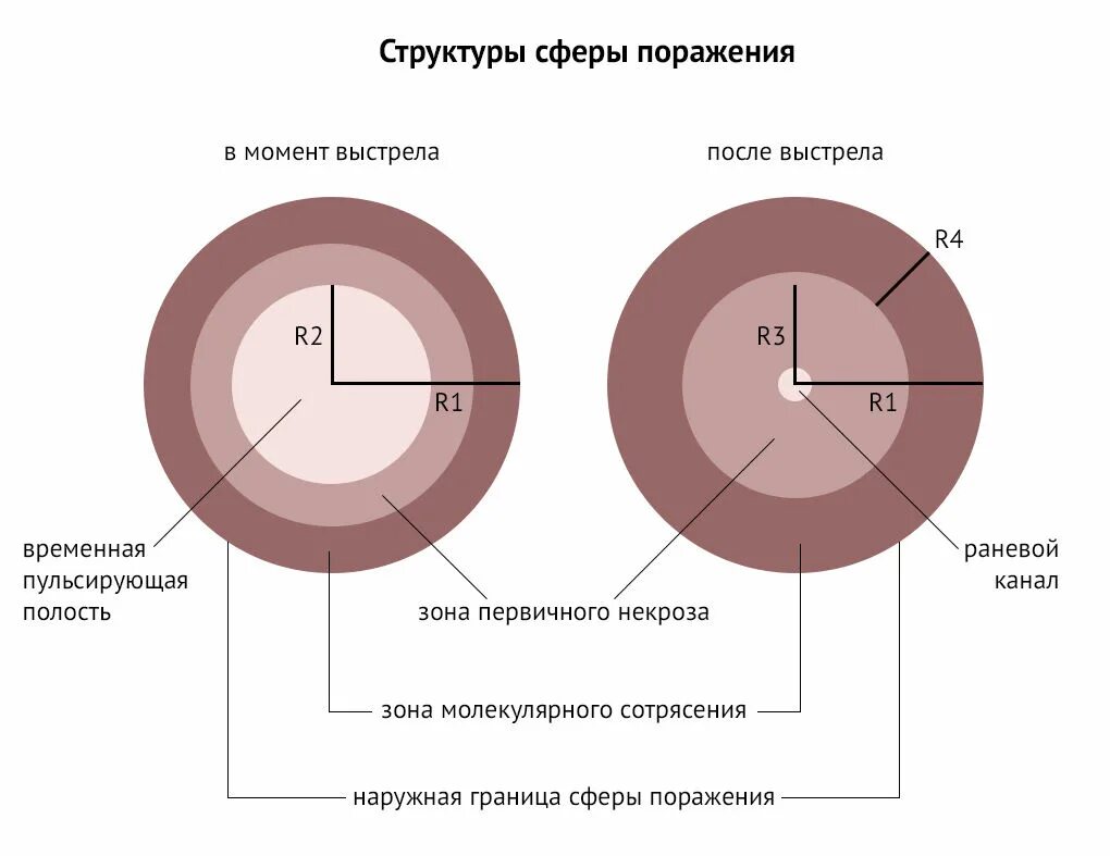 Зоны огнестрельного ранения. Зоны огнестрельного ранения