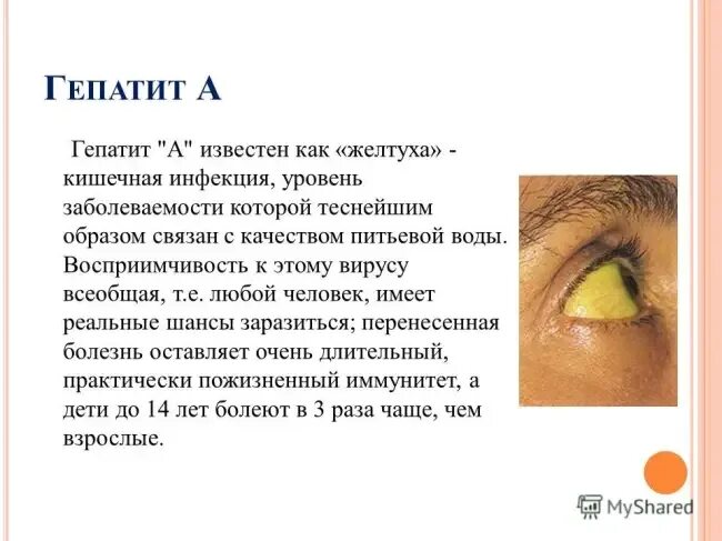 Как лечить желтуху