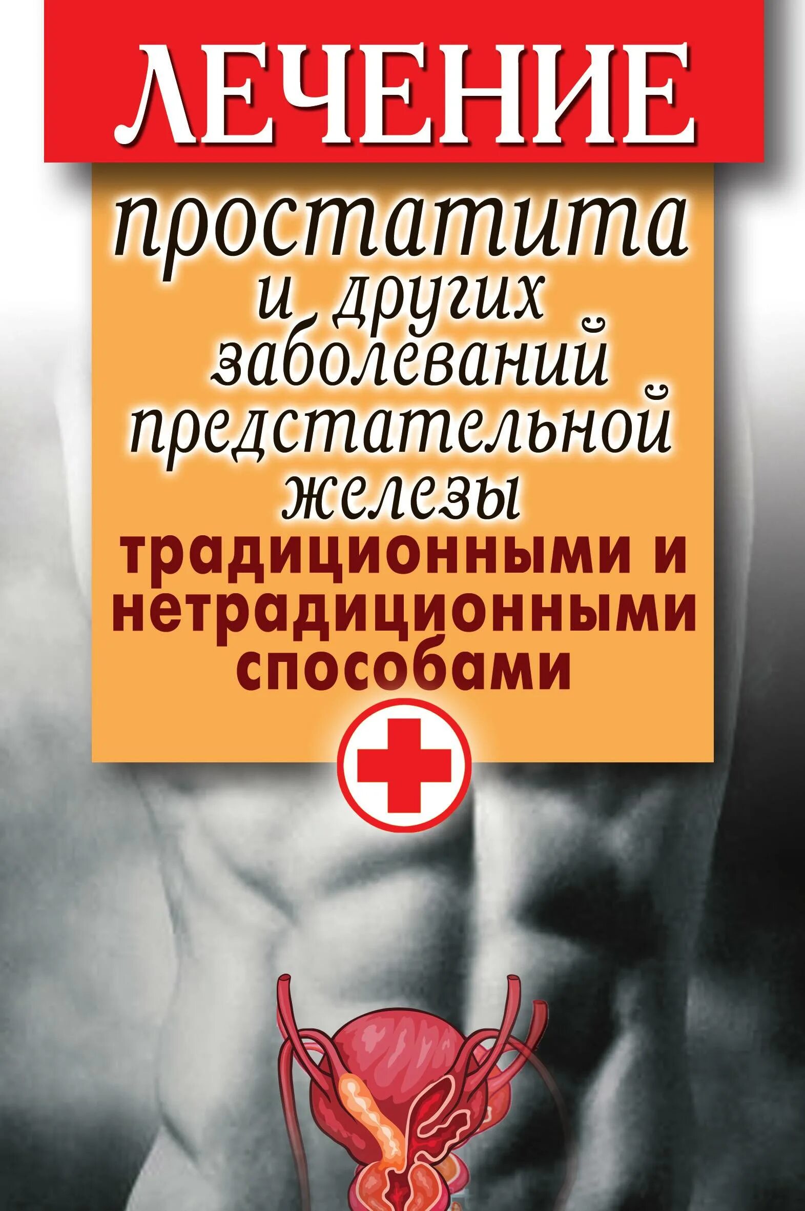 Простатит у молодых. Простатит лекарства. лечебный простатит. заболевание простатит. болезни предстательной железы.