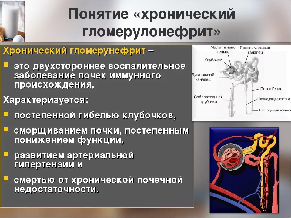 Гломерулонефрит, нефрозонефрит.. Гломерулонефрит воспаление клубочков почки. Хронический диффузный гломерулонефрит симптомы. Клиника острого и хронического гломерулонефрита.