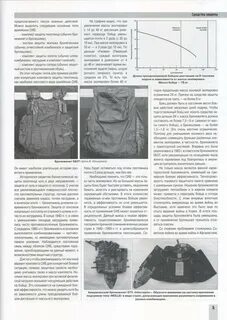 Применение средств индивидуальной бронезащиты
