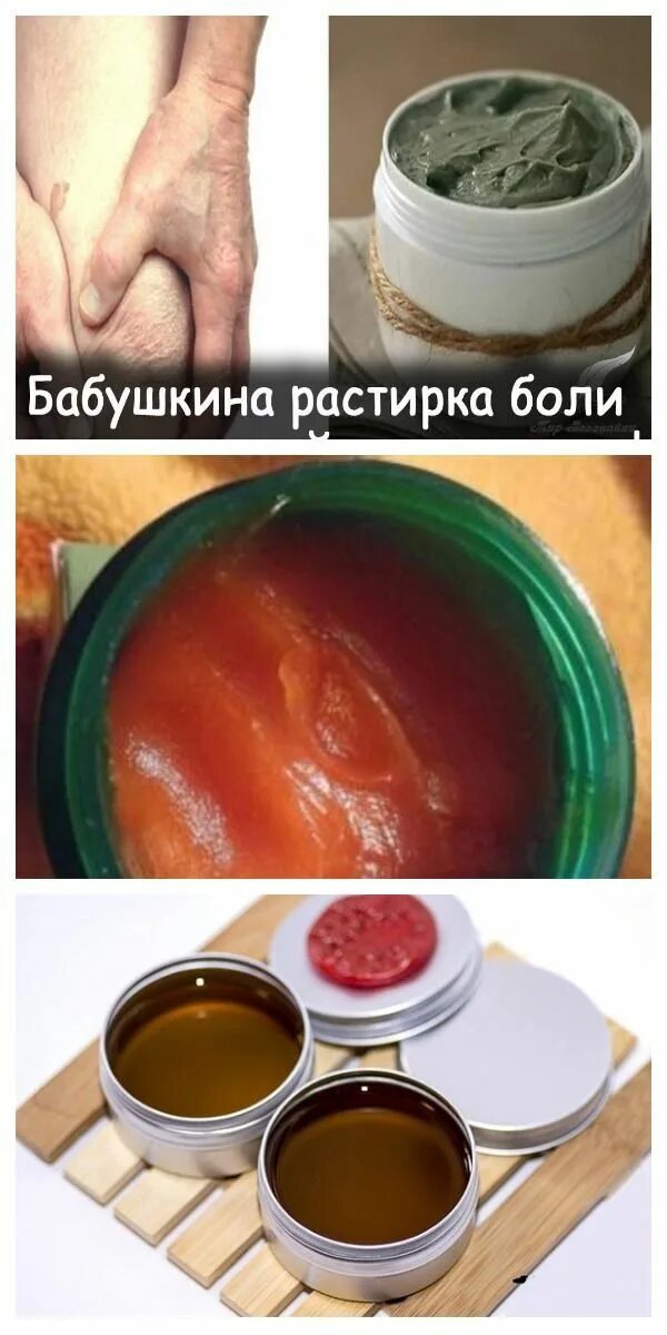 Рецепты растирок для суставов. Растирка для суставов с анальгином йодом. Болей. Рецепты растирок для суставов. Рецепты растирок для суставов.