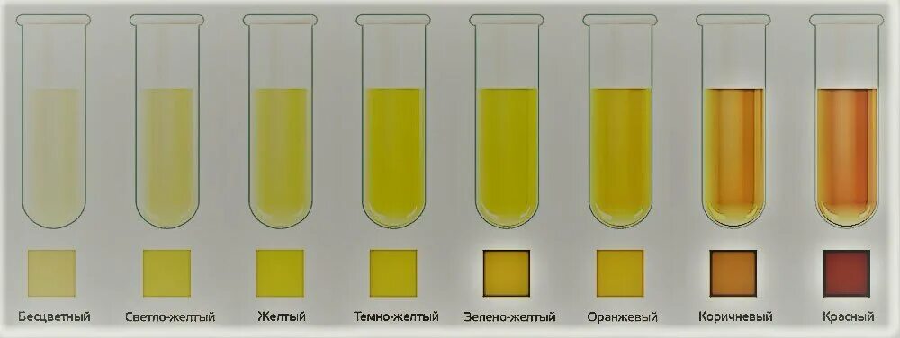 Моча насыщенного желтого цвета. Тёмно-жёлтый цвет мочи. Нормальный цвет мочи. Мояк насыщенного желтого цвета. Сделайте нормальный цвет