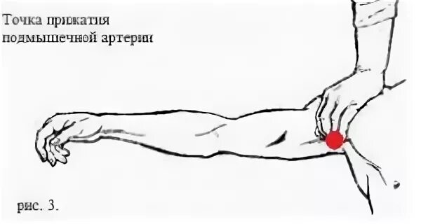 Прижатие подмышечной артерии