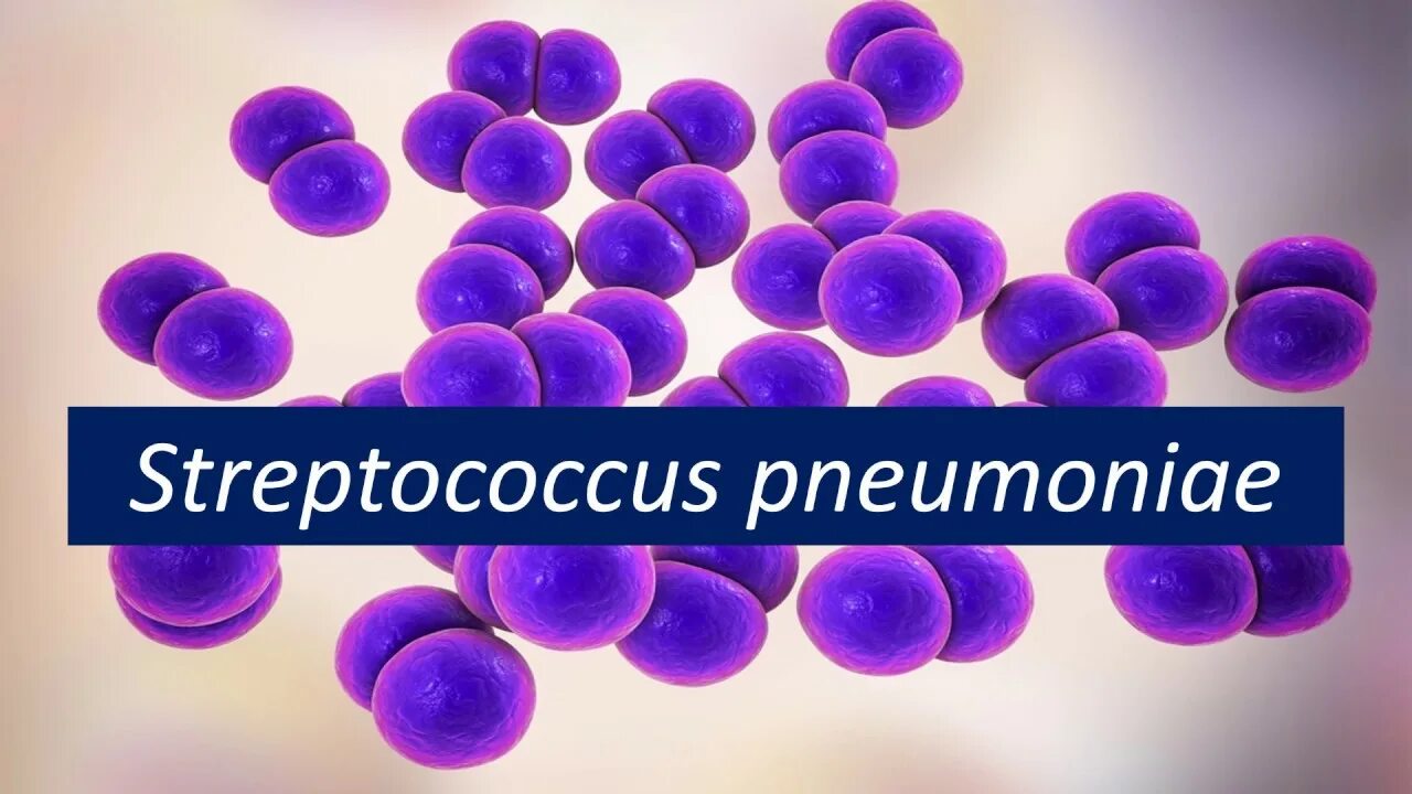 Streptococcus pneumoniae мобилины. Streptococcus pneumoniae (пневмококк). Стрептококк агалактия. Streptococcus pneumoniae картинка. Тест стрептококк группы а