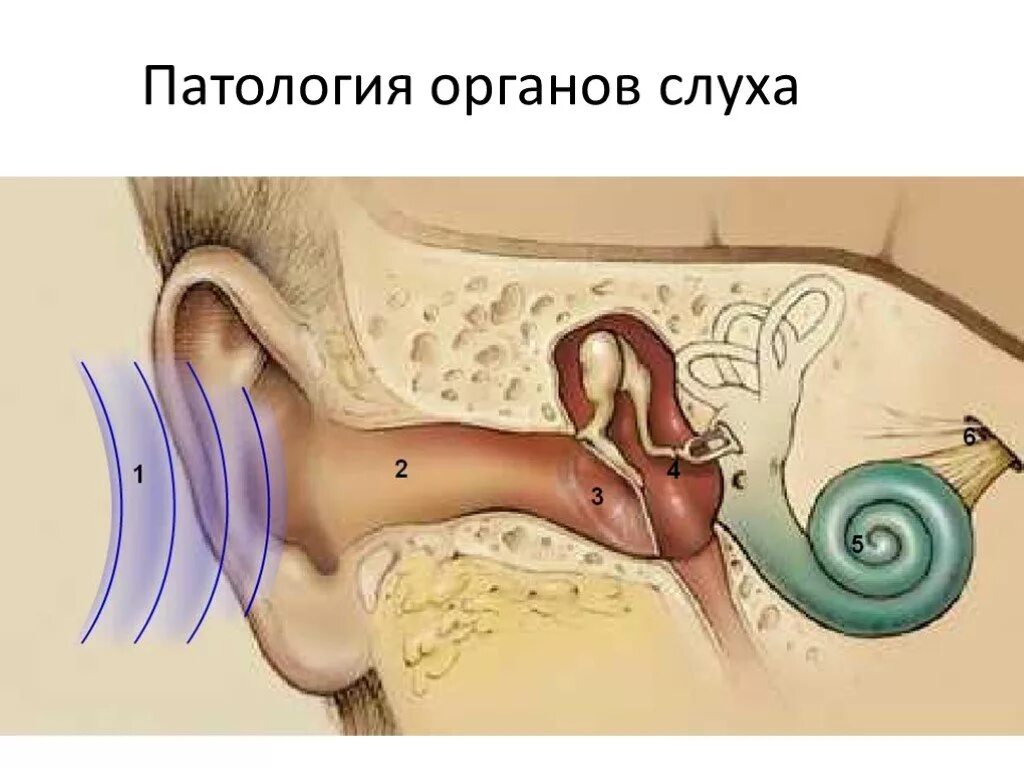 Орган слуха и шум. Патология органов слуха. Строение органа слуха. Строение уха. Строение органа слуха человека.