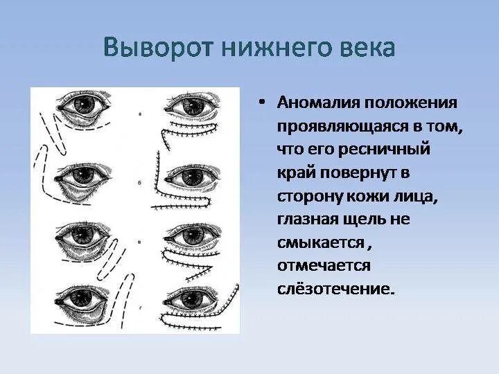 Веки и их значение