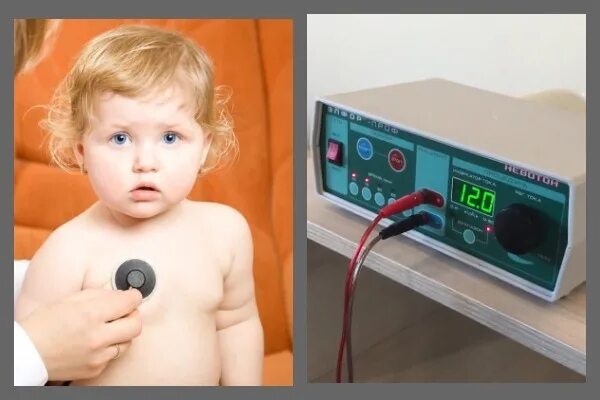 Физиотерапия для новорожденных. Физиотерапия для новорожденных. Электрофорез для детей новорожденных. Электрофорез на шейный отдел ребенку. Электрофорез на шейный отдел ребенку.