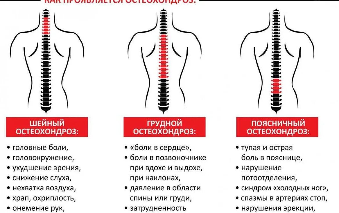 Болит и немеет поясница. Боли при грудном остеохондрозе. Боли при шейном остеохондрозе. Боль при остеохондрозе грудного отдела. Боли при остеохондрозе поясничного отдела позвоночника