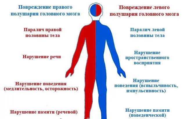 Болит вся левая сторона тела. Осложнения после ишемического инсульта. Ишемический инсульт последствия. Геморрагический инсульт что это такое и последствия. Осложнения геморрагического инсульта.