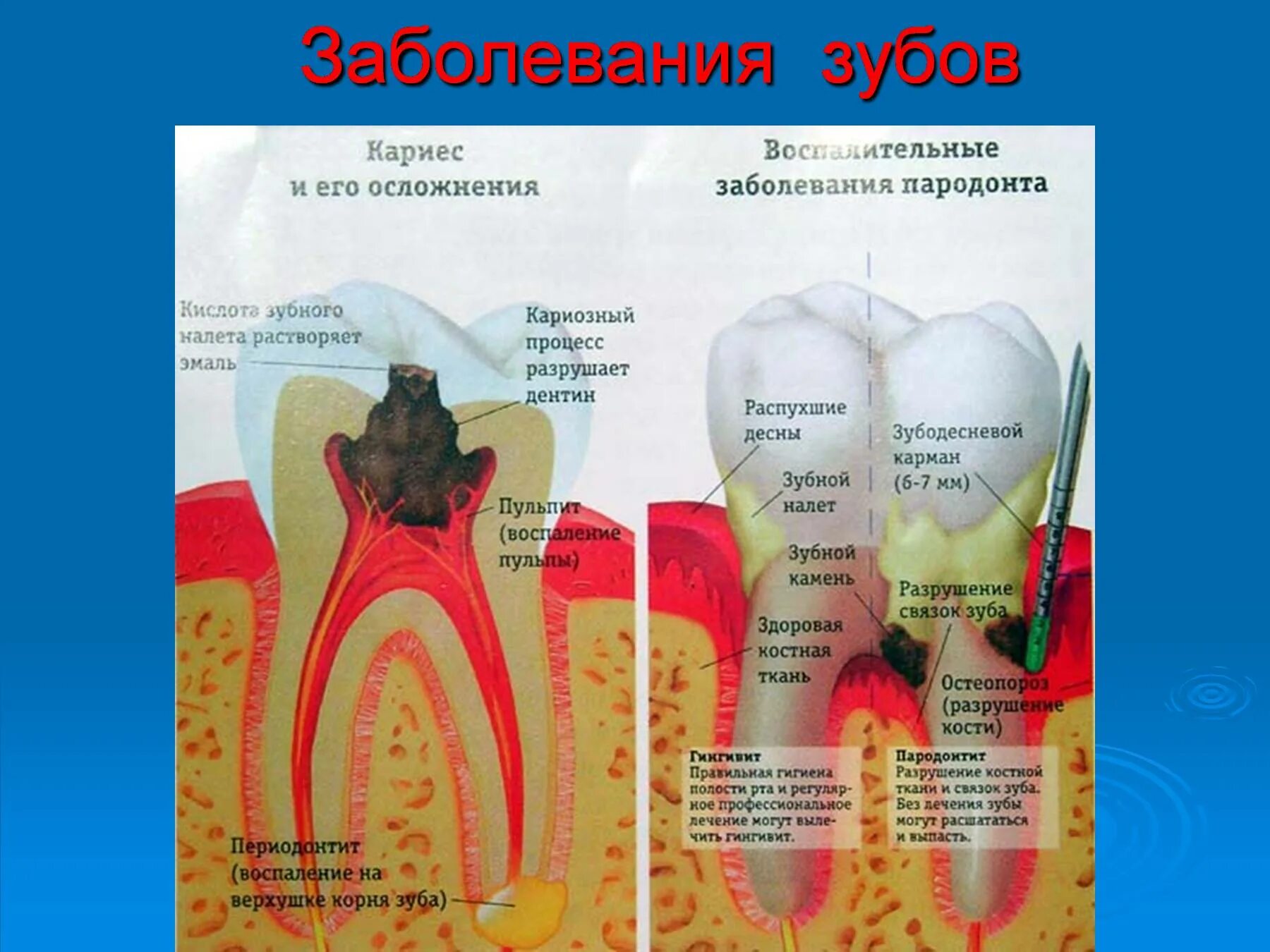 Как называется зуб после. Молочный зуб строение кариес. строение зуба человека кариес. кариес и заболевания пародонта.