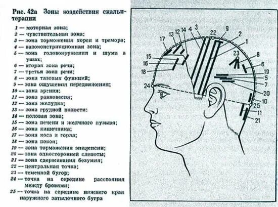 Боль в теменной области головы. Затылочная часть головы. Зоны затылочной части головы.