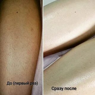 Длина для депиляции воском