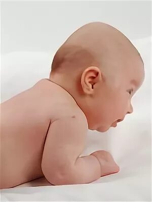 Рахит 5 месяцев