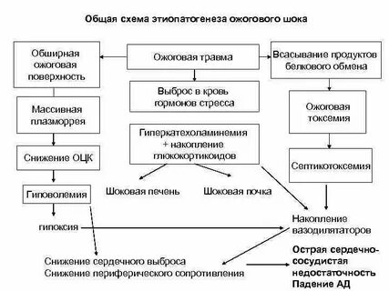 Схема патогенеза шока