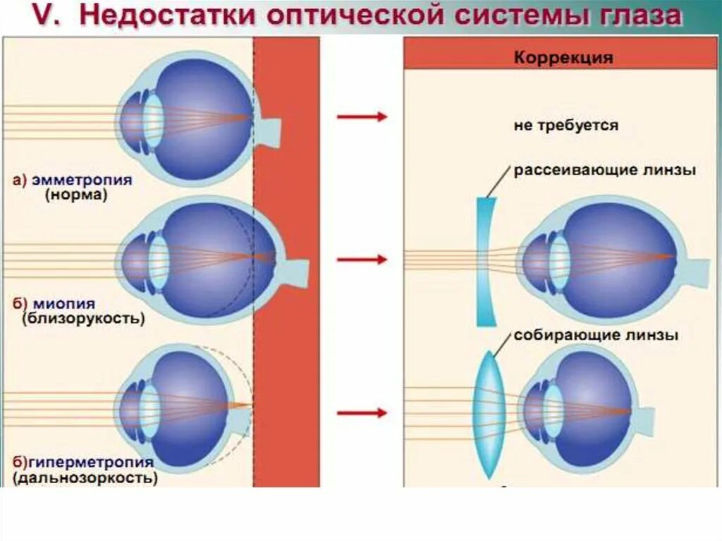 Оптическая система глаза. Компоненты оптической системы глаза. Схема оптической системы глаза. Оптическая система глаза человека. Глаз как оптическая система зрения доклад