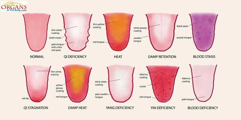 Как определить больной орган. Заболевания по цвету языка. Патологии по цвету языка. Заболевание по цвету языка у человека.