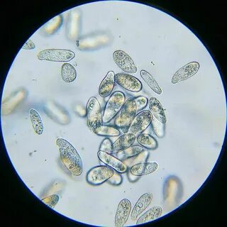 Жыныстық қатынас кезінде ақ разряд серіктесте қалады