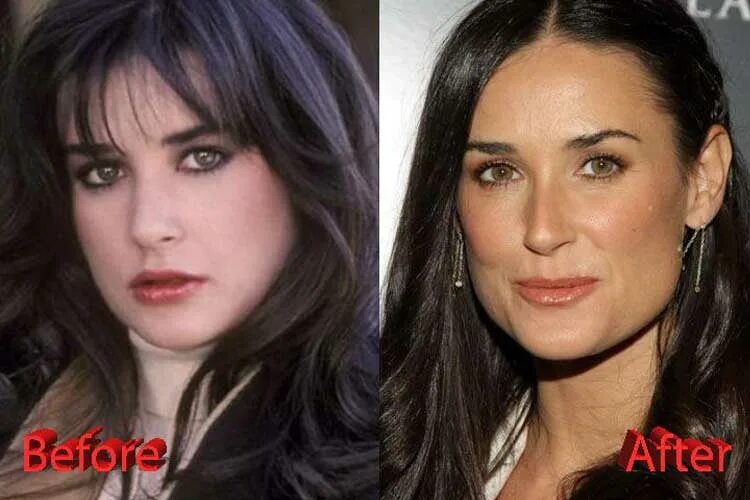 Деми после пластики. Деми мур в молодости. Деми мур после пластики. Деми мур сейчас 2021 пластика. Деми мур пластика.