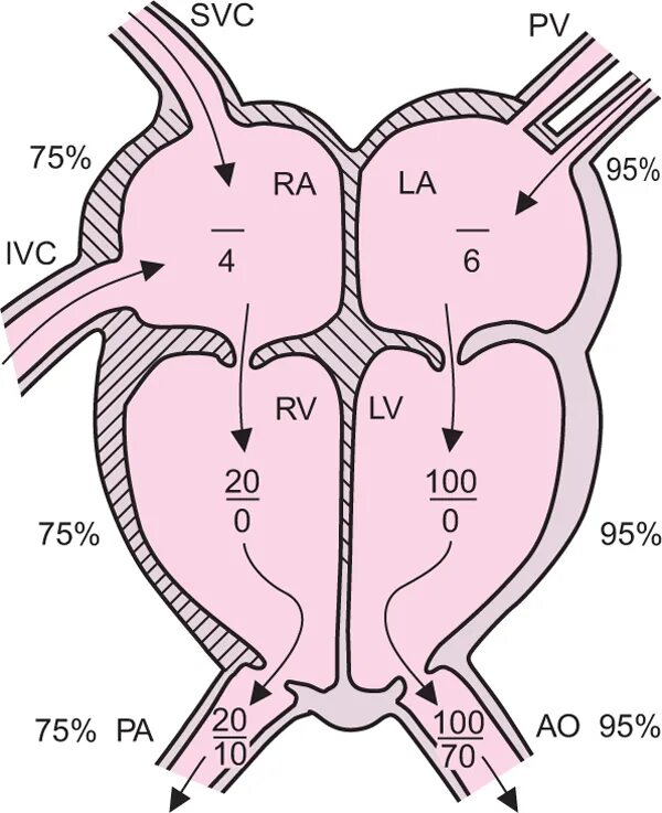 внутрисердечная гемодинамика в норме. градиент давление в полостях сердца в норме. давление в полостях сердца. нормальное давление в камерах сердца. давление в отделах сердца.